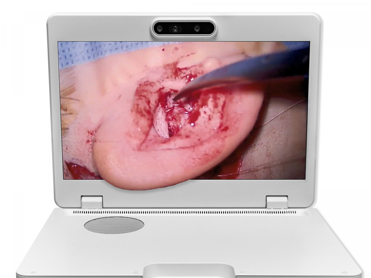 达擎之＂Heads-up 3D显微手术显示系统＂，整合4K裸眼3D显示及眼球追踪系统，具备快速追踪人眼移动位置功能，减轻医师长时间维持固定姿势的负担，让医师能有更宽广清晰的3D立体视野及更舒适的姿势来执行手术。